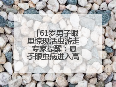 61岁男子眼里惊现活虫游走 专家提醒：夏季眼虫病进入高发期注意防护